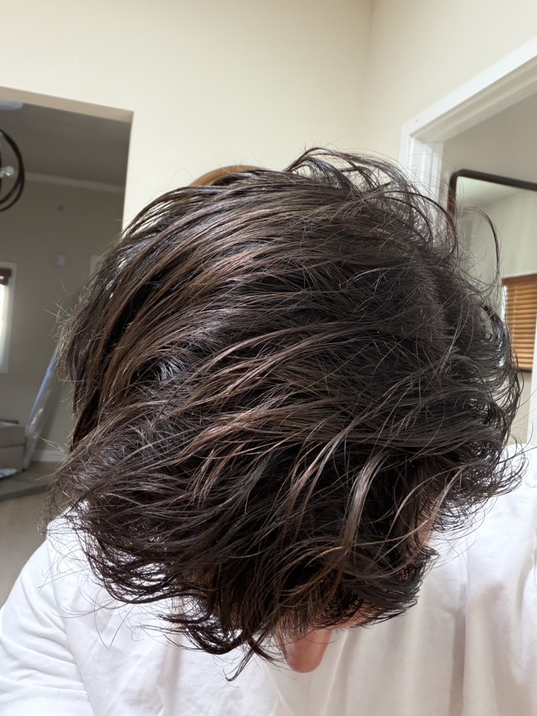 Sam M. (Founder) scalp, Month 9
